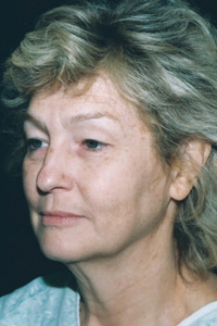 Case--6730 | Before Quick Lift